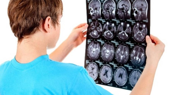 Podium Analytics launched to reduce sports-related injury in  young people